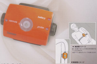 睡眠時無呼吸症候群の検査